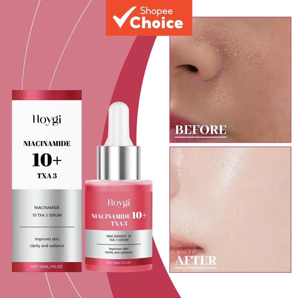 Eelhoe Dark Spot Correcting Glow Serum & Hoygi Niacinamide 10%+TXA 3% Serum